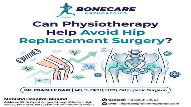 Can Physiotherapy Help Avoid Hip Replacement Surgery?